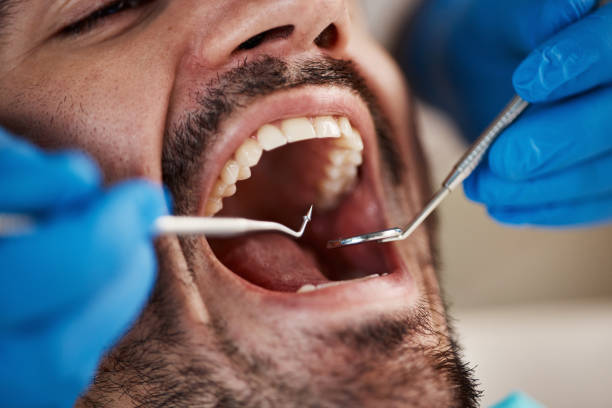 Best Dentist for Tooth Abscess  in Fairlea, WV